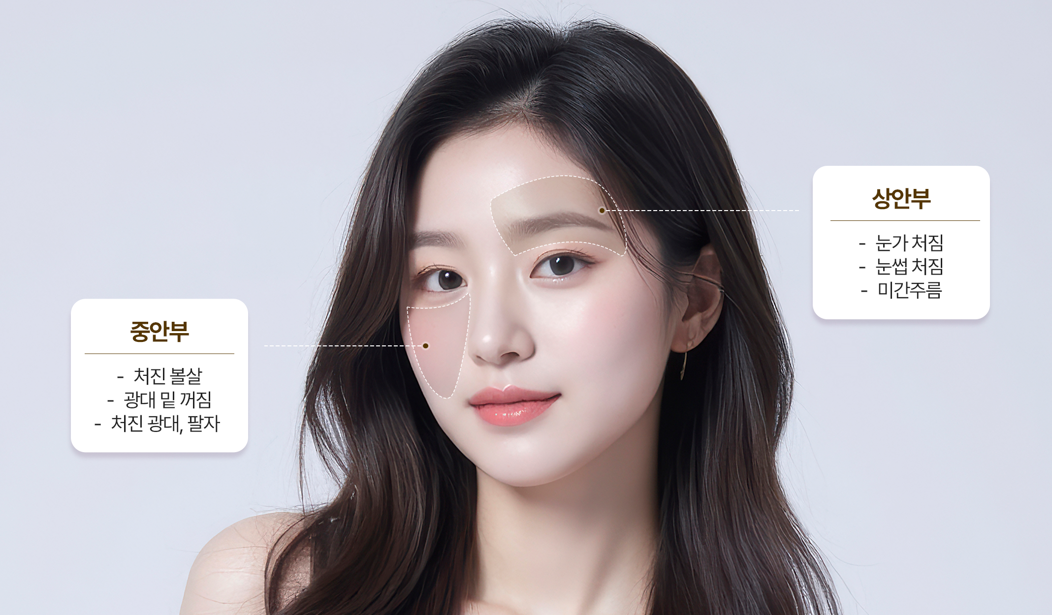 포니테일 리프팅 개선부위
